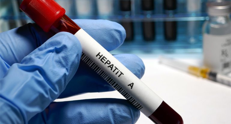 1784985682_1705993617_hepatit_a-1